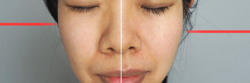 エステで話題のケアが家でまとめてできる「プラチナホワイト RF」を