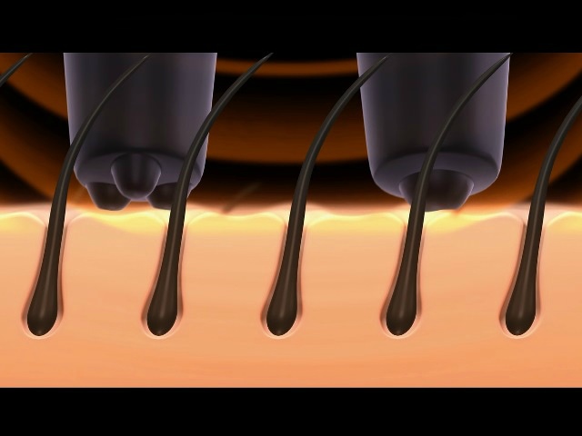 Ƀ_CNgɃAv[`B ԊOł艷߁AUœݗB э܂̎gpOA𐮂̂ɓKĂ܂B