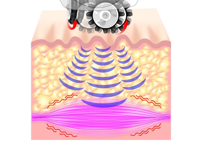 ���݂����C���[�W