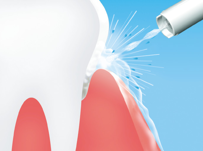 �����|�P�b�g���