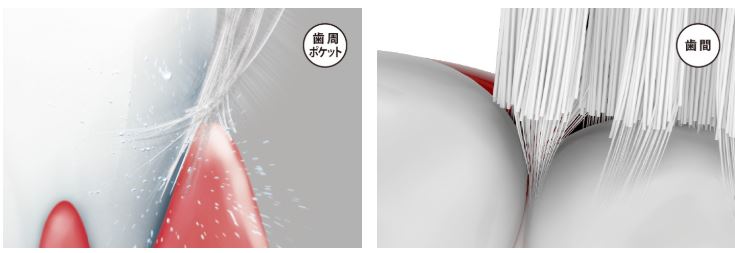 密集極細毛ブラシ歯周ポケットにひそむ歯周病の原因菌をかき出す