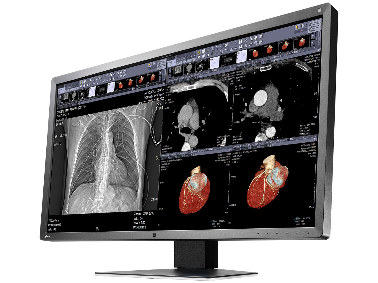 RadiForce MX315W [31.1�C���`]