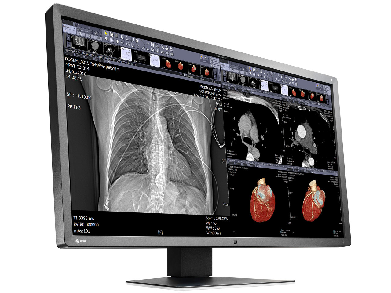 RadiForce MX315W [31.1�C���`]