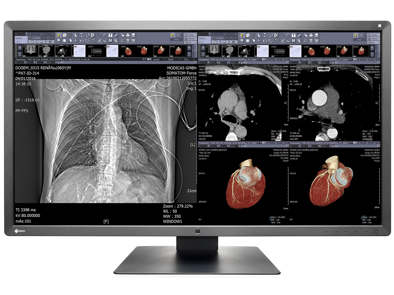 RadiForce MX315W [31.1�C���`] �̐��i�摜