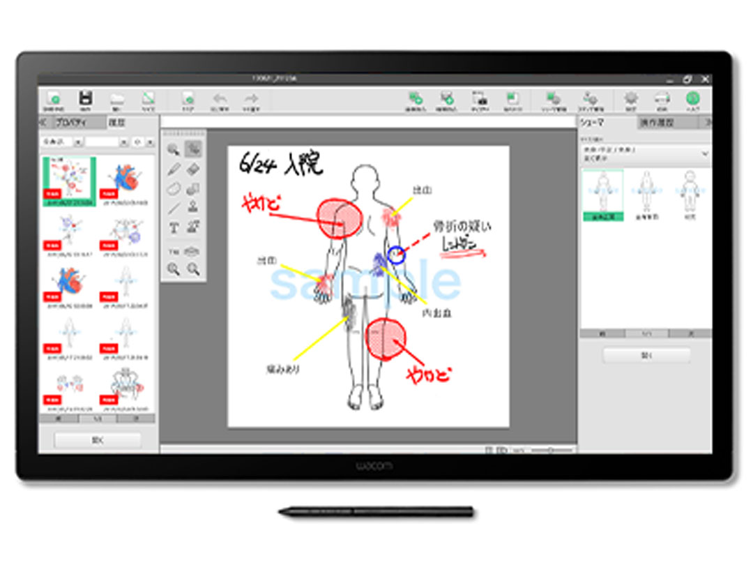 Cintiq 24 ���f�B�J�����f�� DTK246EK4C/MEDICAL �̐��i�摜